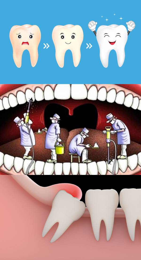 Стоматологи больше не нужны! Зубы могут лечить сами себя