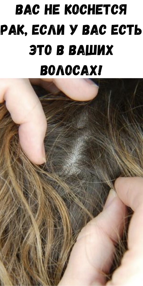 Вас не коснется рак, если у вас есть это в ваших волосах!