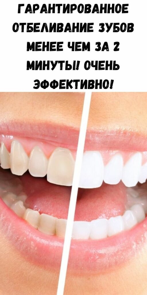 отбеливание зубов курильщикам