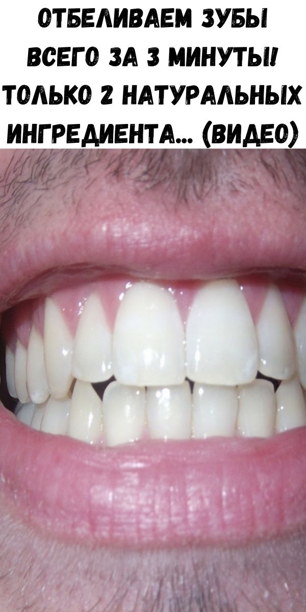 Как отбелить зубы на фото. Как отбелить зубы на фото. Как отбелить зубы на фото. Красивые ровные белые зубы. Как отбелить зубы на фото.