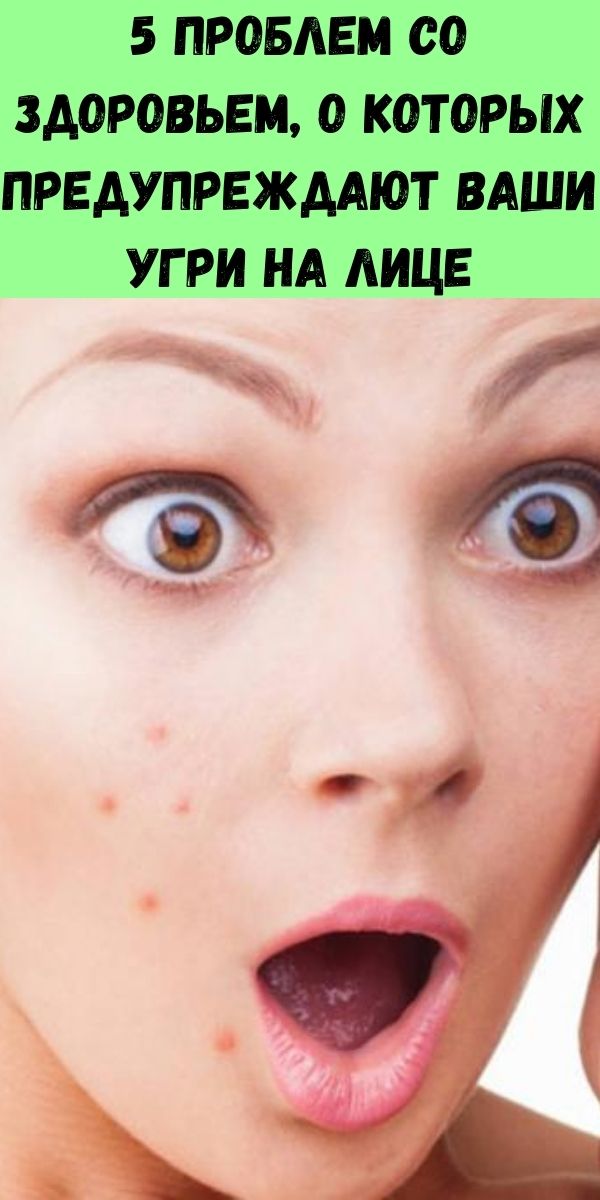 5 проблем со здоровьем, о которых предупреждают Ваши угри на лице