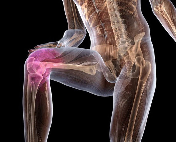 Боль в суставах и костях: 6 природных средств