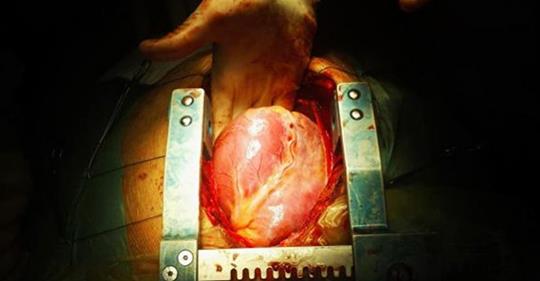 Кардиохирург говорит об истинной причине болезни сердца