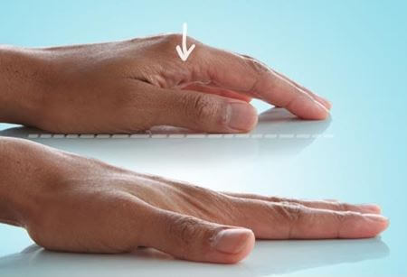 Разминаем пальцы и руки: эффективные упражнения в борьбе с артрозом
