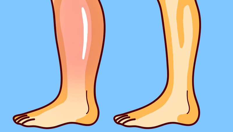 Рекомендация остеопата: 3 простейших упражнения от отека ног
