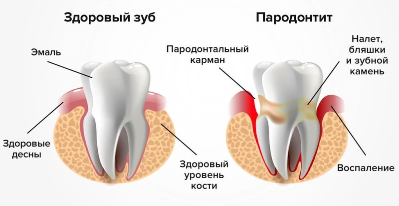 Секрет восточных мудрецов, как сохранить здоровье зубов до старости
