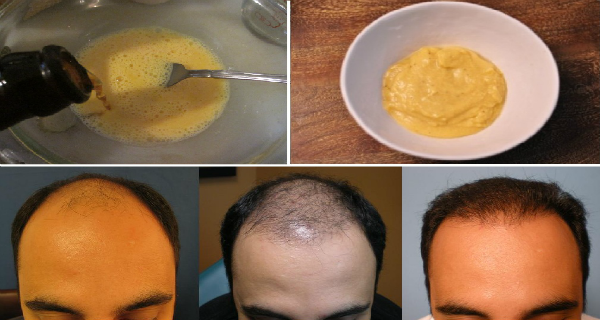 Он смешал бананы и пиво, нанес на волосы - Результаты после 7 дней удивительны!