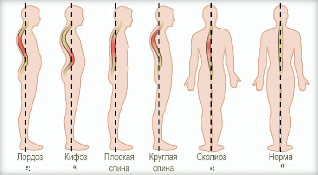 Исправляем осанку: 10 упражнений Исправляем осанку: 10 упражнений