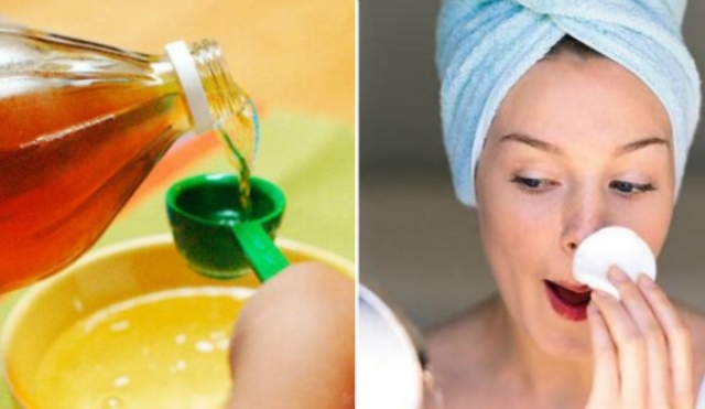 3 ДНЯ И ВСЕ ОТКРЫТЫЕ ПОРЫ ИСЧЕЗНУТ С ВАШЕЙ КОЖИ НАВСЕГДА! 3 ДНЯ И ВСЕ ОТКРЫТЫЕ ПОРЫ ИСЧЕЗНУТ С ВАШЕЙ КОЖИ НАВСЕГДА!