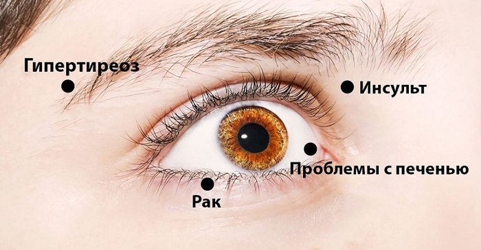 Ваши глаза могут рассказать о здоровье всего организма. 14 вещей!