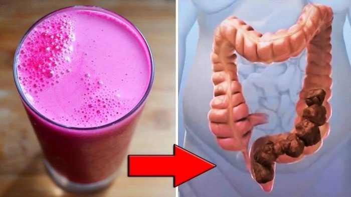 Избавься от запора, проблем с кишечником и пищеварением! Устрани токсины и очисти прямую кишку с этим чудо напитком!