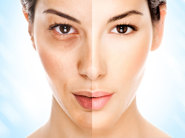 Как избавиться от морщин в 30, 40 и 50 лет