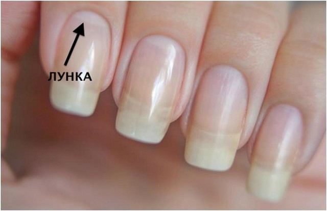 Вот почему могут исчезнуть белые лунки у основания ногтя: не пропусти тревожный симптом!Вот почему могут исчезнуть белые лунки у основания ногтя: не пропусти тревожный симптом!