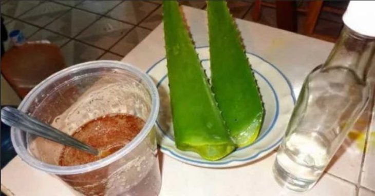 Целебное Алоэ от гепатита, цирроза и для устранения желчнокаменной болезни