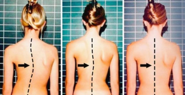 Вот 9 лучших упражнений для позвоночника от мастера Норбекова. Боли уйдут!